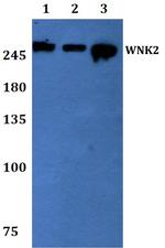 WNK2 Antibody in Western Blot (WB)