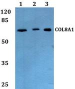 COL8A1 Antibody in Western Blot (WB)