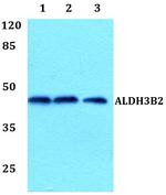 ALDH3B2 Antibody in Western Blot (WB)