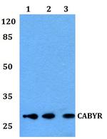 CABYR Antibody in Western Blot (WB)