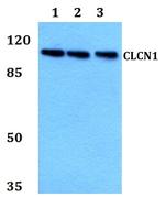 CLCN1 Antibody in Western Blot (WB)