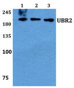 UBR2 Antibody in Western Blot (WB)