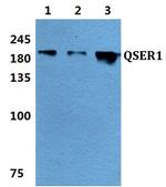 QSER1 Antibody in Western Blot (WB)