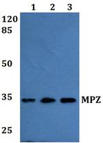 MPZ Antibody in Western Blot (WB)