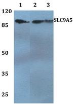 SLC9A5 Antibody in Western Blot (WB)