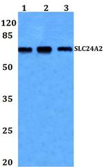 SLC24A2 Antibody in Western Blot (WB)