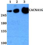 CaV3.1 Antibody in Western Blot (WB)