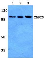 ZNF25 Antibody in Western Blot (WB)