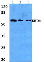 KRT84 Antibody in Western Blot (WB)