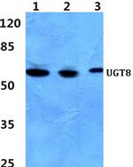 UGT8 Antibody in Western Blot (WB)