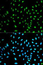 NCF2 Antibody in Immunocytochemistry (ICC/IF)