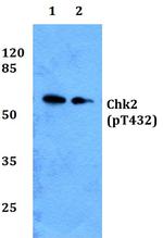 Phospho-CHK2 (Thr432) Antibody in Western Blot (WB)