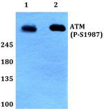 Phospho-ATM (Ser1987) Antibody in Western Blot (WB)