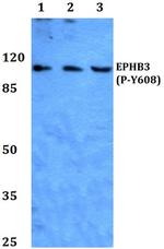 Phospho-EphB3 (Tyr608) Antibody in Western Blot (WB)