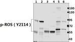 Phospho-ROS1 (Tyr2114) Antibody in Western Blot (WB)