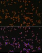 CHI3L1 Antibody in Immunocytochemistry (ICC/IF)