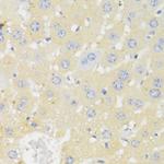 CYP11A1 Antibody in Immunohistochemistry (Paraffin) (IHC (P))