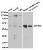 CYP11A1 Antibody in Western Blot (WB)