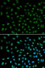 DDB2 Antibody in Immunocytochemistry (ICC/IF)