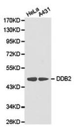 DDB2 Antibody in Western Blot (WB)