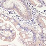 HMGCR Antibody in Immunohistochemistry (Paraffin) (IHC (P))