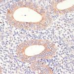 HMGCR Antibody in Immunohistochemistry (Paraffin) (IHC (P))