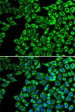 LIPC Antibody in Immunocytochemistry (ICC/IF)