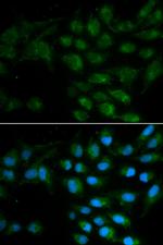 LIPC Antibody in Immunocytochemistry (ICC/IF)