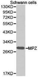 MPZ Antibody in Western Blot (WB)