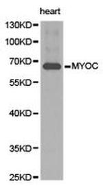 MYOC Antibody in Western Blot (WB)