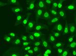 RFC1 Antibody in Immunocytochemistry (ICC/IF)