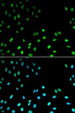 RFC1 Antibody in Immunocytochemistry (ICC/IF)