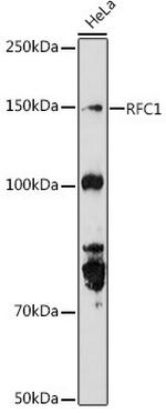 RFC1 Antibody in Western Blot (WB)