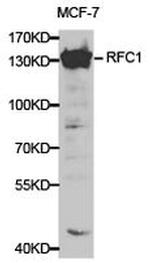 RFC1 Antibody in Western Blot (WB)