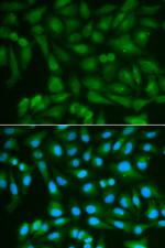 Sorbitol Dehydrogenase Antibody in Immunocytochemistry (ICC/IF)