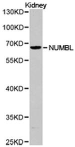 NUMBL Antibody in Western Blot (WB)