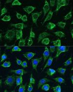 PTPN22 Antibody in Immunocytochemistry (ICC/IF)