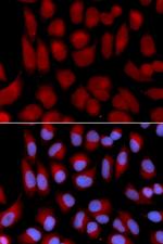 TAP2 Antibody in Immunocytochemistry (ICC/IF)