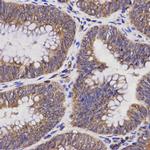 TAP2 Antibody in Immunohistochemistry (Paraffin) (IHC (P))