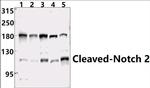 NOTCH2 (Cleaved Ala1734) Antibody in Western Blot (WB)