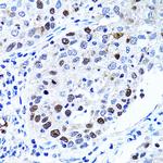 UHRF1 Antibody in Immunohistochemistry (Paraffin) (IHC (P))