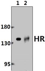 Hairless Antibody in Western Blot (WB)