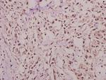 Hairless Antibody in Immunohistochemistry (Paraffin) (IHC (P))