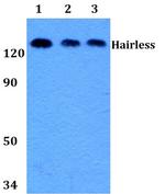 Hairless Antibody in Western Blot (WB)