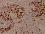 SPINK5 Antibody in Immunohistochemistry (Paraffin) (IHC (P))