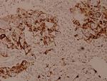 SPINK5 Antibody in Immunohistochemistry (Paraffin) (IHC (P))