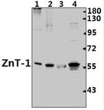 SLC30A1 Antibody in Western Blot (WB)