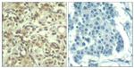 Phospho-AKT1 (Thr450) Antibody in Immunohistochemistry (Paraffin) (IHC (P))