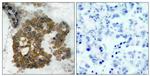 Phospho-AKT2 (Ser474) Antibody in Immunohistochemistry (Paraffin) (IHC (P))