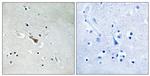 Phospho-APLP2 (Tyr755) Antibody in Immunohistochemistry (Paraffin) (IHC (P))